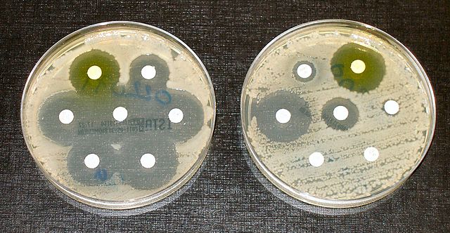 Superbugs and Superproblems