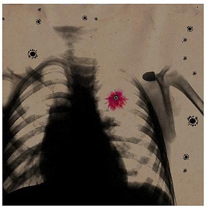 An image designed like an X-Ray to depict a skeleton with several holes depicted, including one over the skeleton's heart.