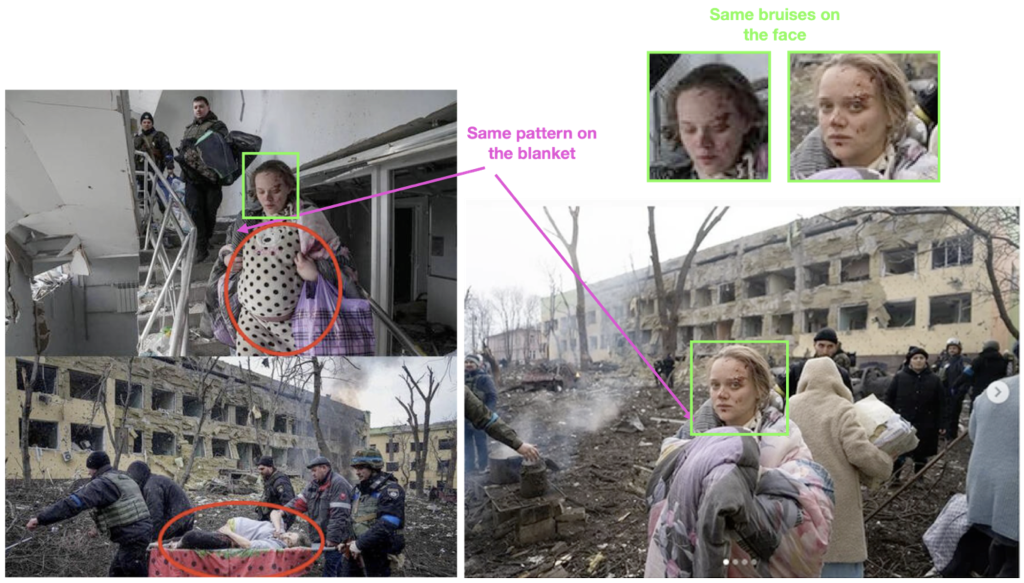 Visual comparison of photos of pregnant women who were injured in the bombing. The red circles (left) show the false comparison by REN TV. The pink arrows point at the same pattern on the blanket (top left and bottom right). Green frames compare matching bruises on Vyshemirskaya’s face. (Source: REN TV/archive, left; KP.ru/archive, right) 